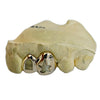 10K Gold Double Cap Star Cutout & Open Face Tooth Custom Grillz