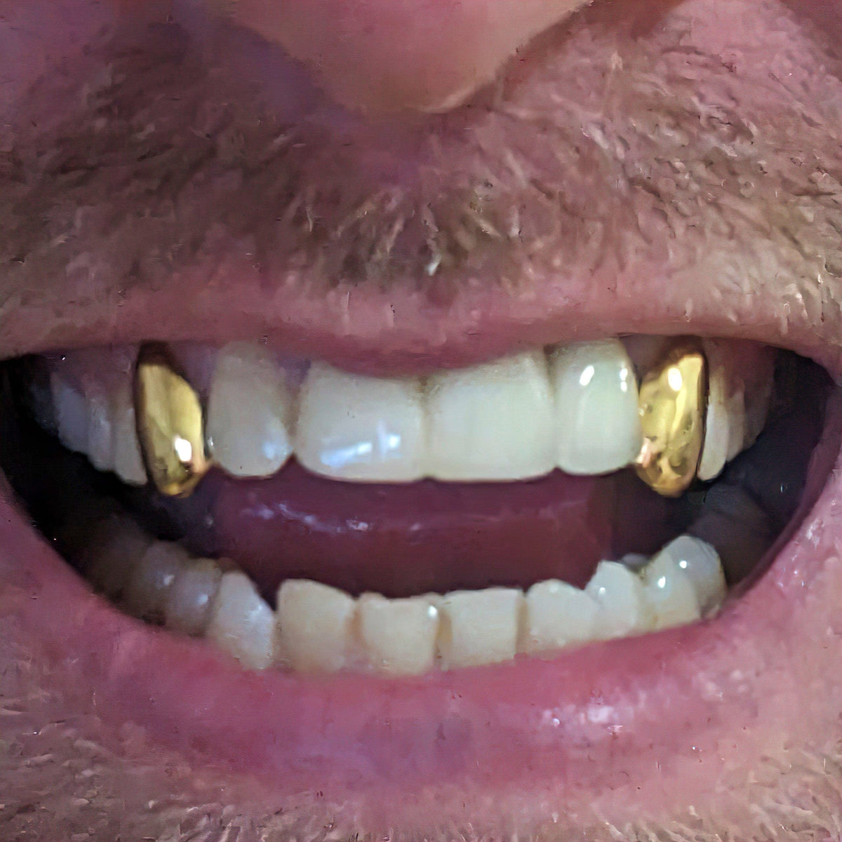 DreamGold - Grillz 1 dent + gravure - Or 18K