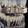 14K Gold Plated Diamond-Cut Top Teeth Grillz