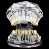 14K Gold Plated Grillz Four Open Face Diamond-Cut 4 Windows Bottom Teeth