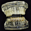 18K Gold Plated CZ Iced Bottom Vampire Fang Teeth Grillz