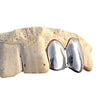 Real 10K White Gold Double Caps Side Canine Custom Grillz