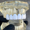Real Solid 925 Sterling Silver White Enamel Top Six Teeth Grillz