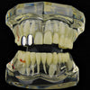 Silver Tone Double Caps Teeth Grillz - Right Hand Side