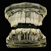 Silver Tone with w/14K Gold Plated Diamond-Cuts Bottom Teeth Grillz