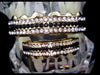 14K Gold Plated Black Iced 3-Row Grillz Set