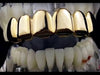 14K Gold Plated Plain Top Teeth Grillz