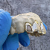 10K Gold Diamond Cut Open Face Teeth Custom Grillz