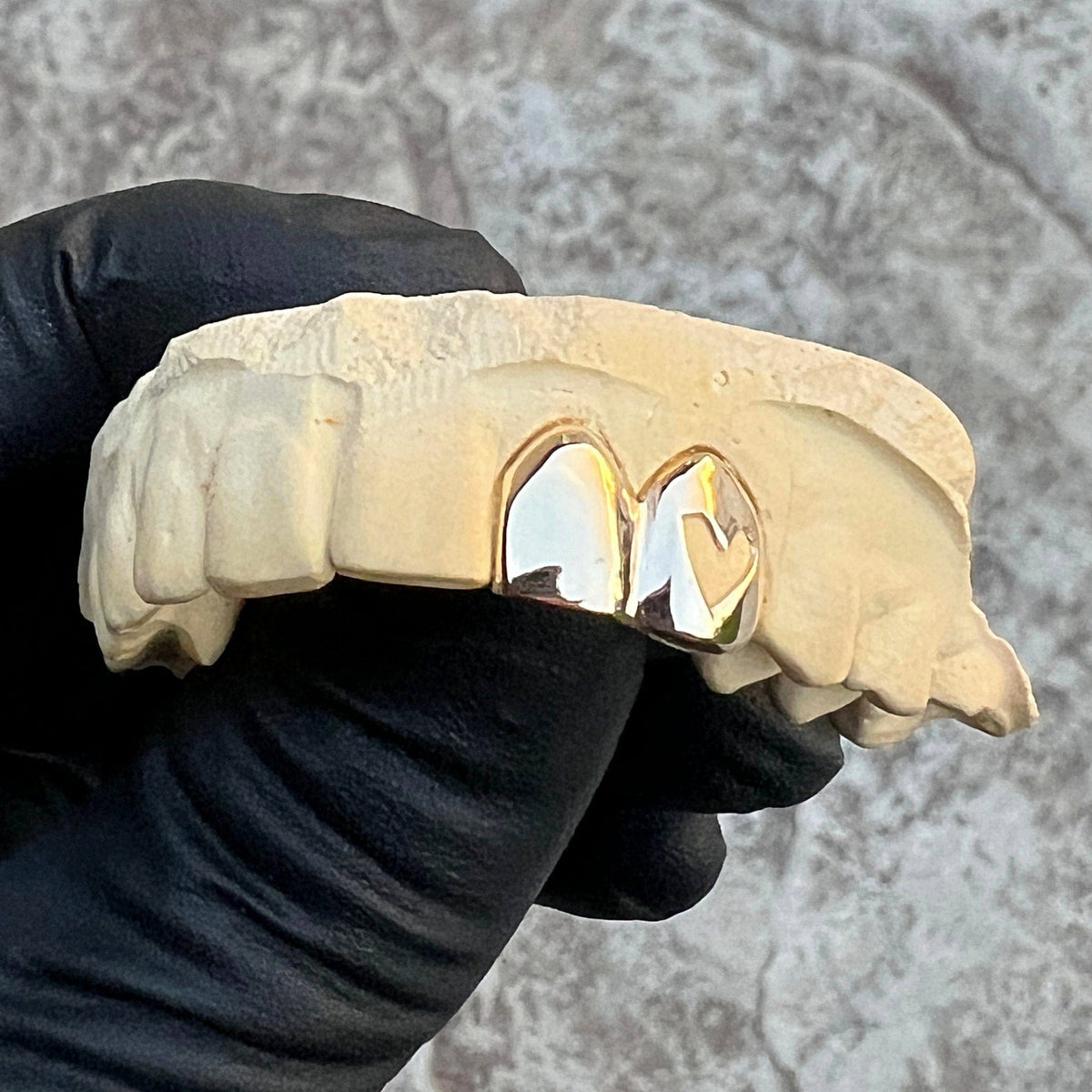 Tooth Custom 10K Gold Double Cap Heart Cutout & SOLID Tooth Custom Grillz