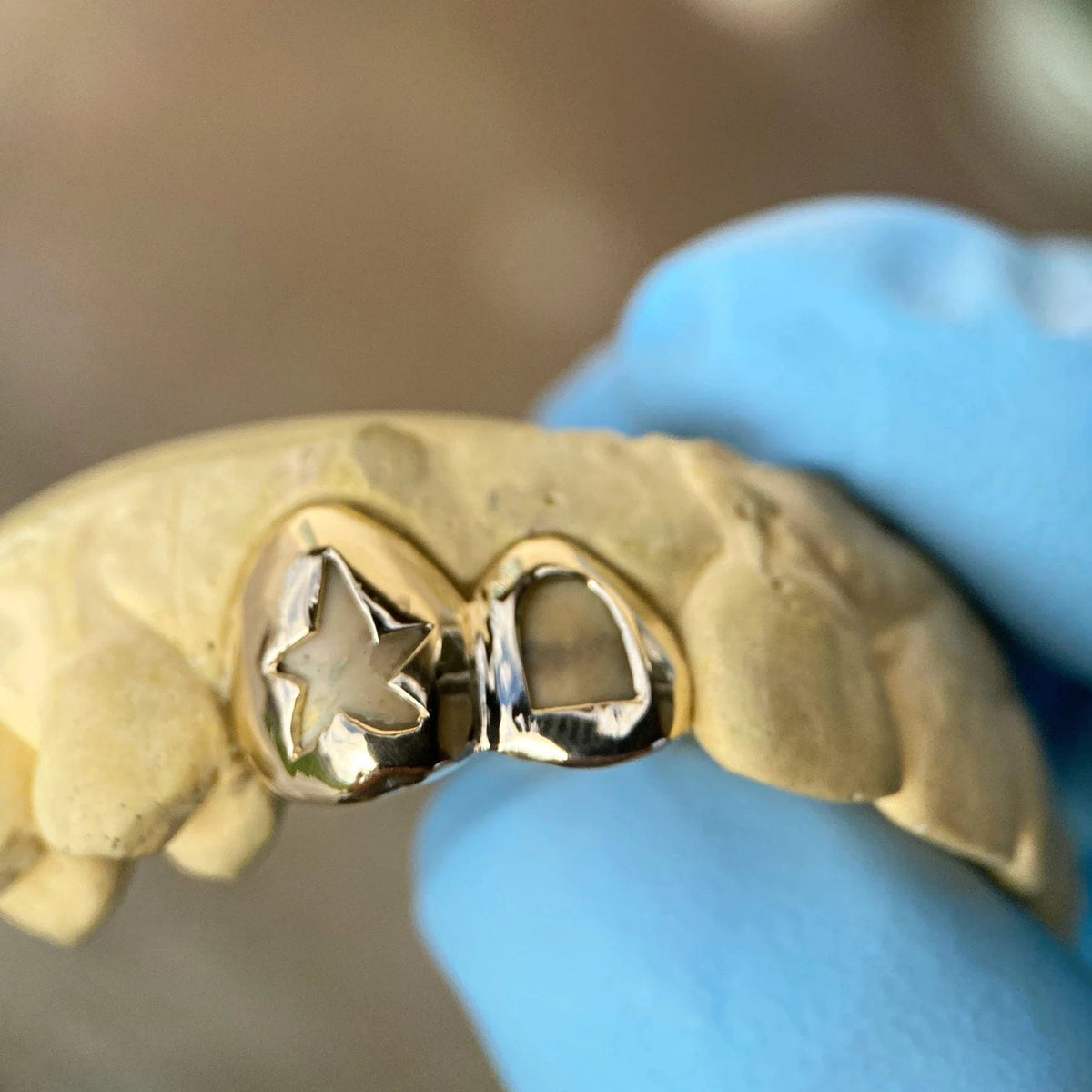 Tooth Custom 10K Gold Double Cap Star Cutout & Open Face Tooth Custom Grillz