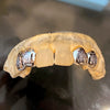 10K Gold Double Cap Two-Tone Diamond Dust Custom Grillz