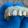 10K Gold Single Caps w/Front Diamond Dust Teeth Custom Grillz