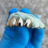 10K Gold Single Caps w/Front Diamond Dust Teeth Custom Grillz