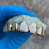 10K Gold Single Caps w/Front Diamond Dust Teeth Custom Grillz