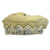 10K Gold Two-Tone Diamond-Cut Diamond Dust Custom Grillz