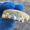 10K Gold Two-Tone Diamond-Cut Diamond Dust Custom Grillz