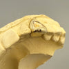 10K or 14K Gold Open Face Tooth Cap Diamond Dust (Choose Tooth)