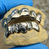 10K White Gold Two-Tone Starburst Custom Grillz