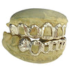 14K Gold Diamond Cut Diamond Dust Open Face Custom Grillz