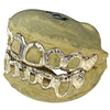 14K Gold Diamond Cut Diamond Dust Open Face Custom Grillz