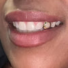 14K Gold Open Face Single Cap Custom Grillz (Choose Tooth)