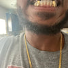 14K Gold or 18K Gold Single Caps w/Back Bar Custom Canine Grillz Set