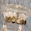 14k Gold Plated 2 Open Face Six Top Teeth Grillz