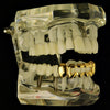 14K Gold Plated 4 Full Open Face Hollow Bottom Teeth Grillz