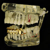 14K Gold Plated 4 Full Open Face Hollow Bottom Teeth Grillz