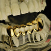 14K Gold Plated 4 Full Open Face Hollow Bottom Teeth Grillz