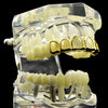 14K Gold Plated 6 Open Face Top Teeth Grillz