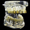 14K Gold Plated 6 Open Face Top Teeth Grillz