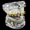 14K Gold Plated 6 Open Face Top Teeth Grillz