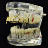 14K Gold Plated 6 Open Face Top Vampire Fangs Grillz