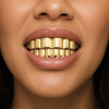 14k Gold Plated 6 Top and 6 Bottom Teeth Cartel Grillz Set