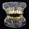 14K Gold Plated 8 on 6 Teeth Grillz Set