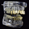 14K Gold Plated 8 on 6 Teeth Grillz Set