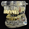 14K Gold Plated 8 on 6 Teeth Grillz Set