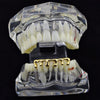 14K Gold Plated Bottom Teeth Melting Dripping Drip Grillz