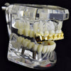 14K Gold Plated Cuban Link Iced CZ Top Teeth Grillz