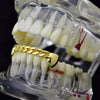 14K Gold Plated Cuban Link Plain Bottom Teeth Grillz