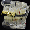 14K Gold Plated Cuban Link Plain Top Teeth Vampire Fangs