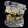 14K Gold Plated Cuban Link Plain Vampire Fangs Set