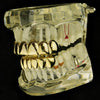 14K Gold Plated Deeper-Cut Teeth Grillz Set