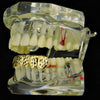 14K Gold Plated Diamond-Cut Bottom Teeth Grillz