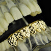 14K Gold Plated Diamond-Cut Bottom Teeth Grillz