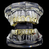 14K Gold Plated Diamond-Cut Four Open Face 4 Windows Grillz Set