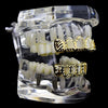 14K Gold Plated Diamond-Cut Four Open Face 4 Windows Grillz Set