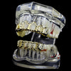 14K Gold Plated Diamond-Cut Four Open Face 4 Windows Grillz Set