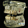 14K Gold Plated Diamond-Cut Teeth Grillz Set